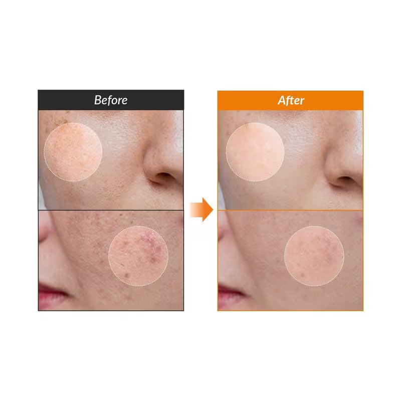 Dr. Althea Vitamin C Boosting Serum 30ml