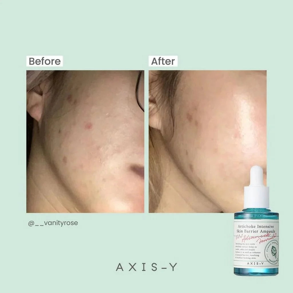 AXIS-Y Artichoke Intensive Skin Barrier Ampoule 30ml