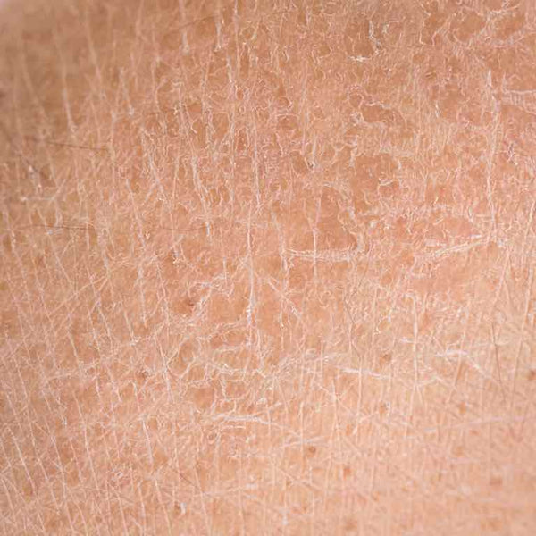 Quruq teri