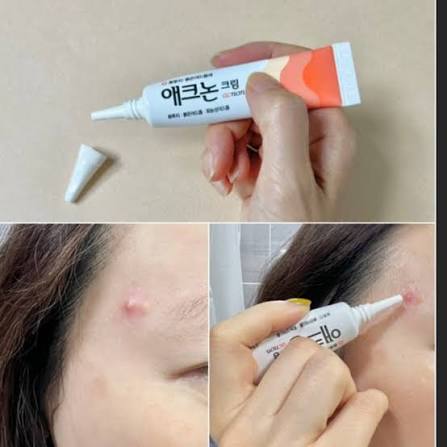 Acnon Cream Korean Spot Treatment 13ml