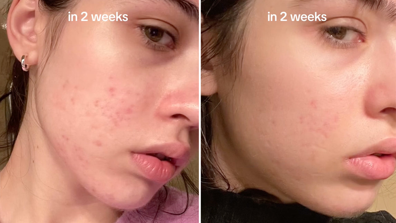 Anua Niacinamide 10 + TXA 4 Serum 30ml