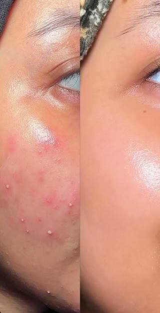 AXIS-Y Spot the Difference Blemish Treatment 15ml